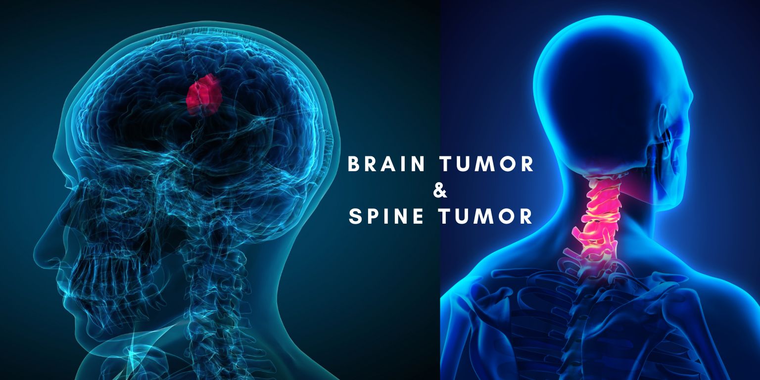 Dr. Patnaik's Brain Spine & Heart Care Centre - Brain Tumor & Spinal Cord tumor surgery  | Dr. Pavitra Patnaik