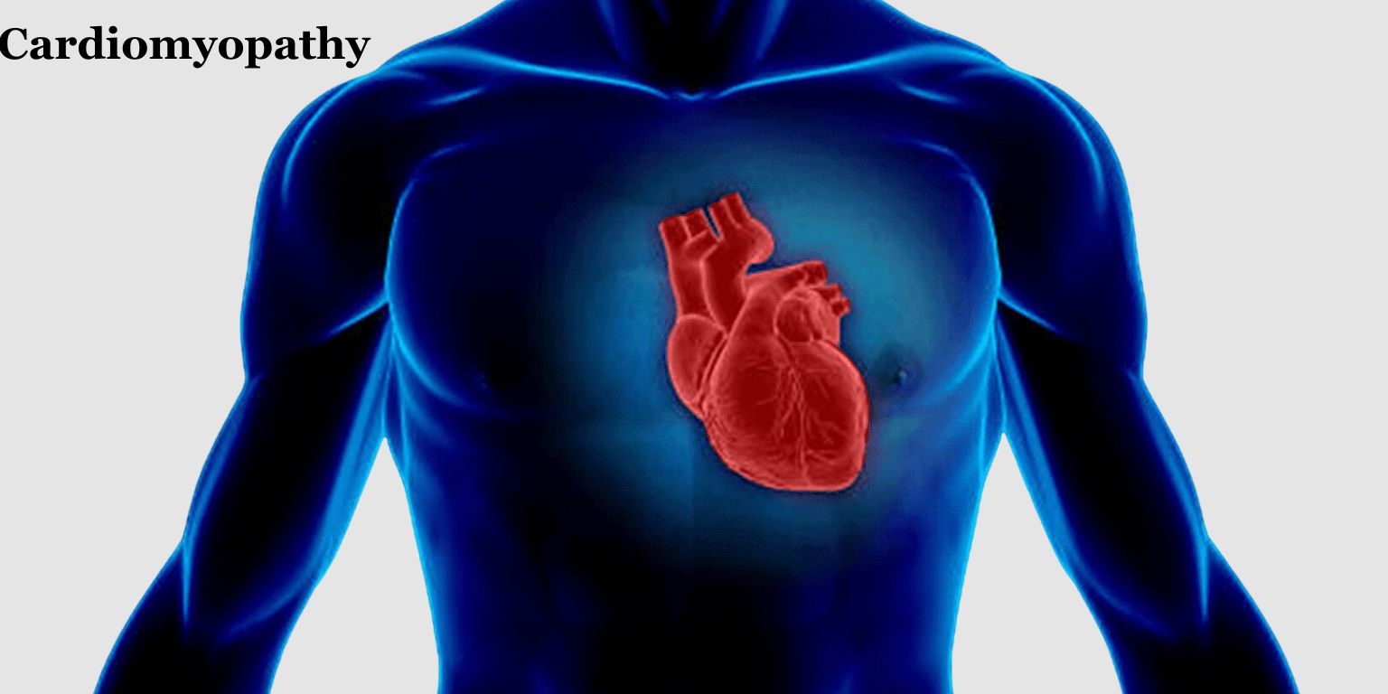 Dr. Patnaik's Brain Spine & Heart Care Centre - Cardiomyopathy | Dr Neeta Patnaik