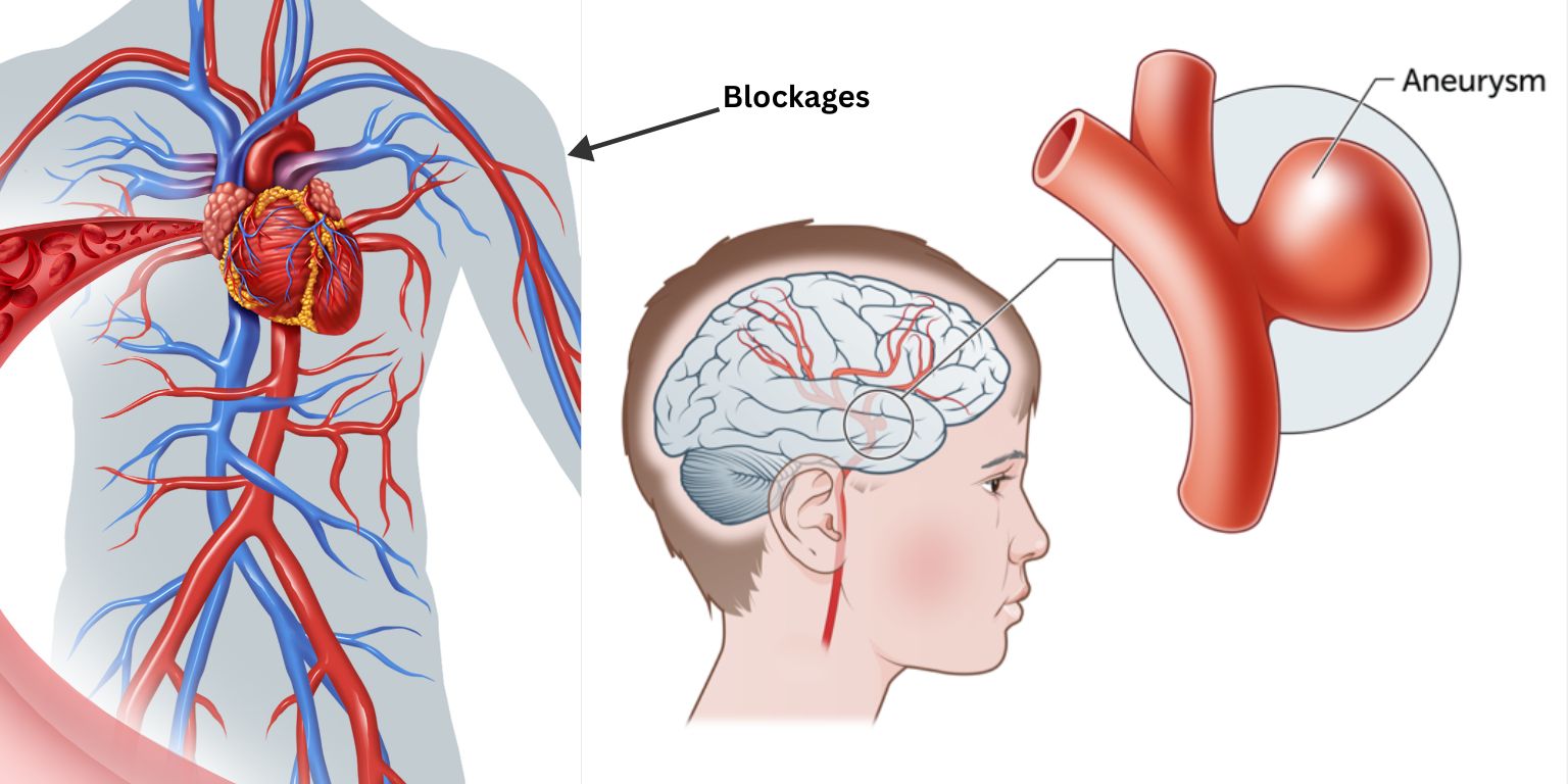 Dr. Patnaik's Brain Spine & Heart Care Centre - Vascular Neurosurgery | Dr. Pavitra Patnaik